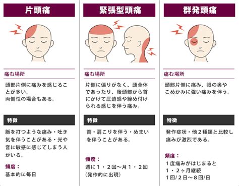 頭痛|頭痛の種類まとめ～それぞれの違いと原因、症状、治。